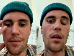 Mendadak Batalkan Konser, Justin Bieber Alami Kelumpuhan Wajah Sebelah