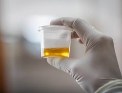 Kasus Gagal Ginjal Akut, IDI Lampung Imbau Para Ibu Waspada Jika Produksi Urine Anak Sedikit